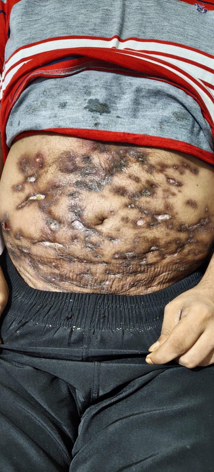 Help Malik Muneer Ahmed Win His Battle for Life
